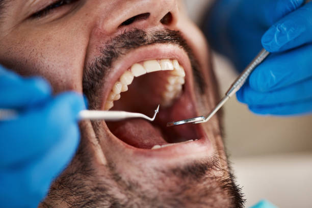 Oral Cancer Screening in Kearny, NJ